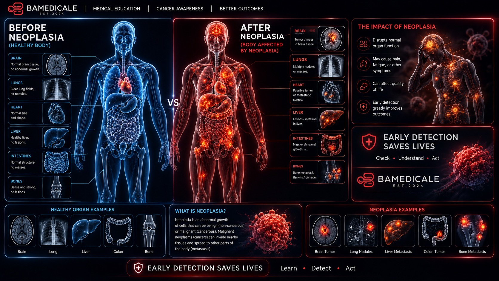 Before and after neoplasia educational infographic comparing normal anatomy with neoplasia