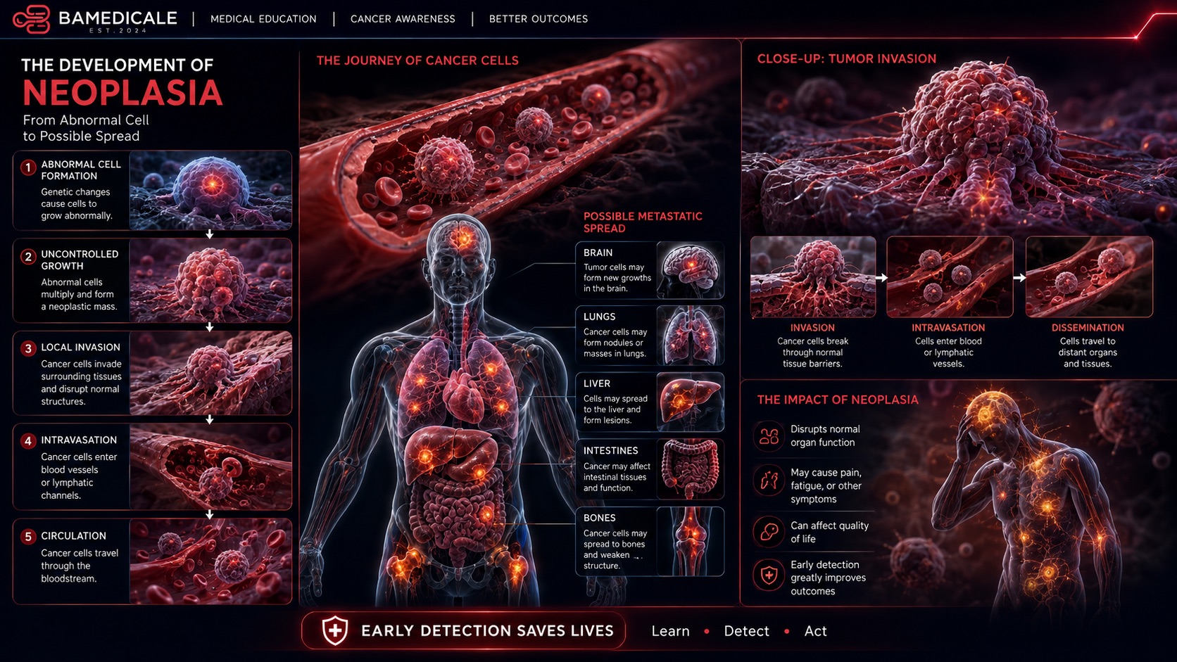 Development of neoplasia educational infographic showing abnormal growth and possible spread